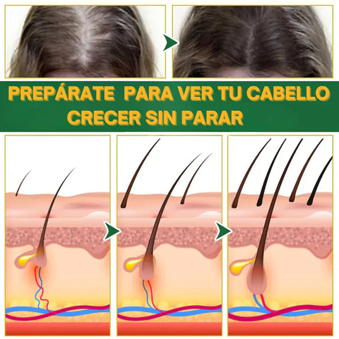 Image of OUHOE - ELIXIR CAPILAR PARA CRECIMIENTO Y CAIDA DE CABELLO Y BARBA